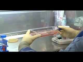 Knee Surgery: Arthroscopic Delivery of the MACI Implant