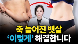 처진뱃살로 고민이신 분들은 안보면 100% 후회하는 영상 [복부성형, 복부거상, 처