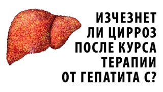 Изчезнет ли цирроз после курса терапии от гепатита С