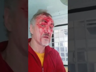 Обыкновенный фашизм, прикрывающийся короновирусом.