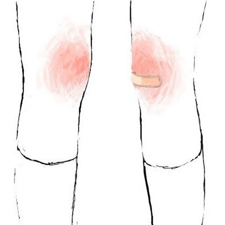 Коленки рисунок