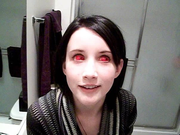 Inserting Both Red Sclera Lenses by 9mm Special